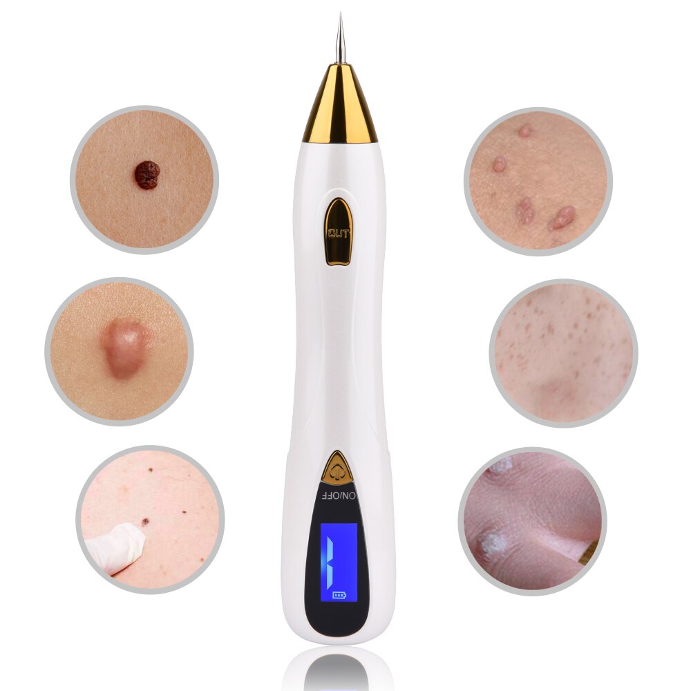 Laser Mole Tattoo Freckle Removal